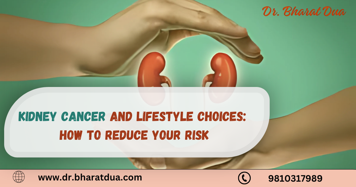Kidney Cancer and Lifestyle Choices: How to Reduce Your Risk